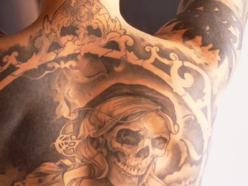 man with tattoo for removing tattoo