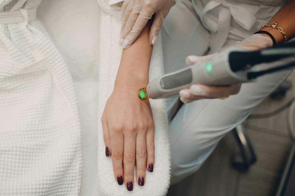 laser treatment in hands
