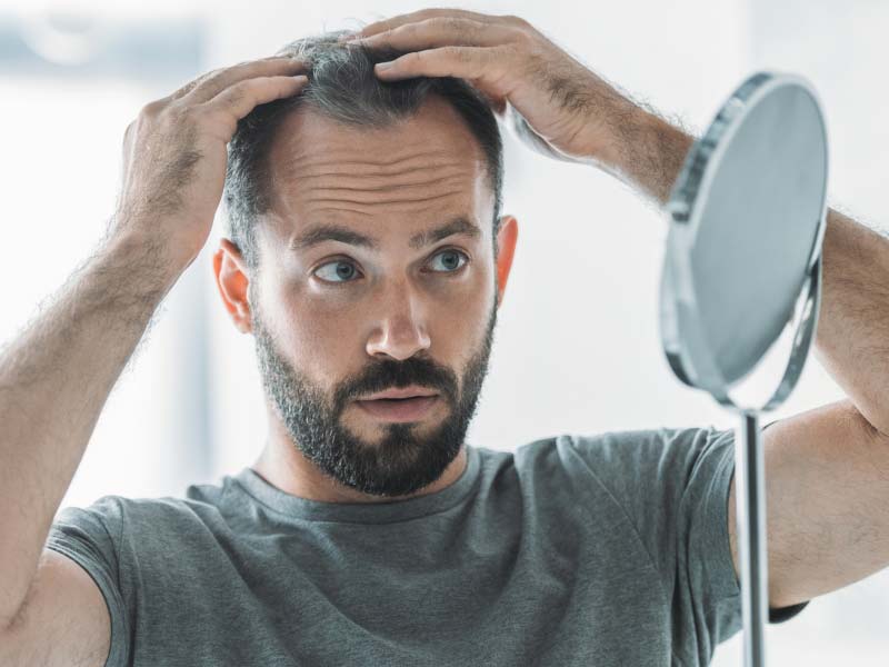 bearded mid adult man with hair loss looking at mirror