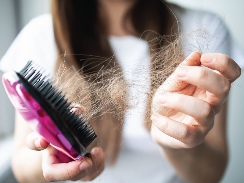 hands of a comb with fallen hair trichologist