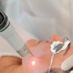 Advanced Laser Treatments for Stubborn Sun Damage