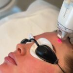 5 Effective Treatments for Tightening Loose Skin