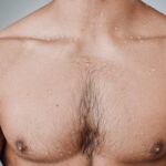Should Guys Get Laser Hair Removal